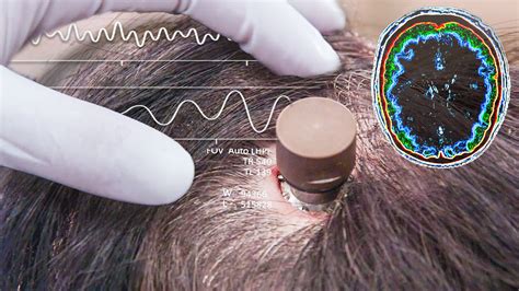 schizophrenia and rfid chips|Engineering brain.